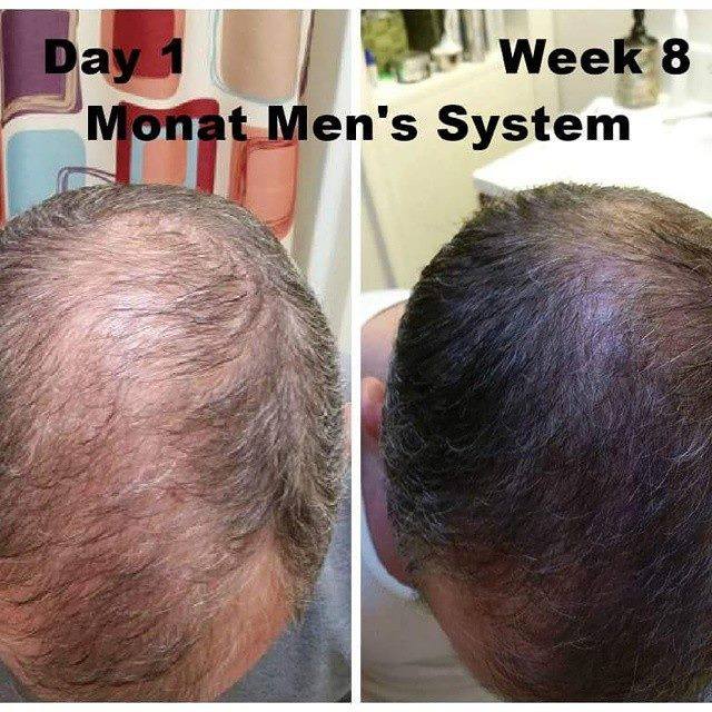 Monat Mens Before and AFter